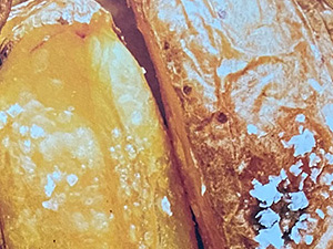 Kartoffeln und Pommes